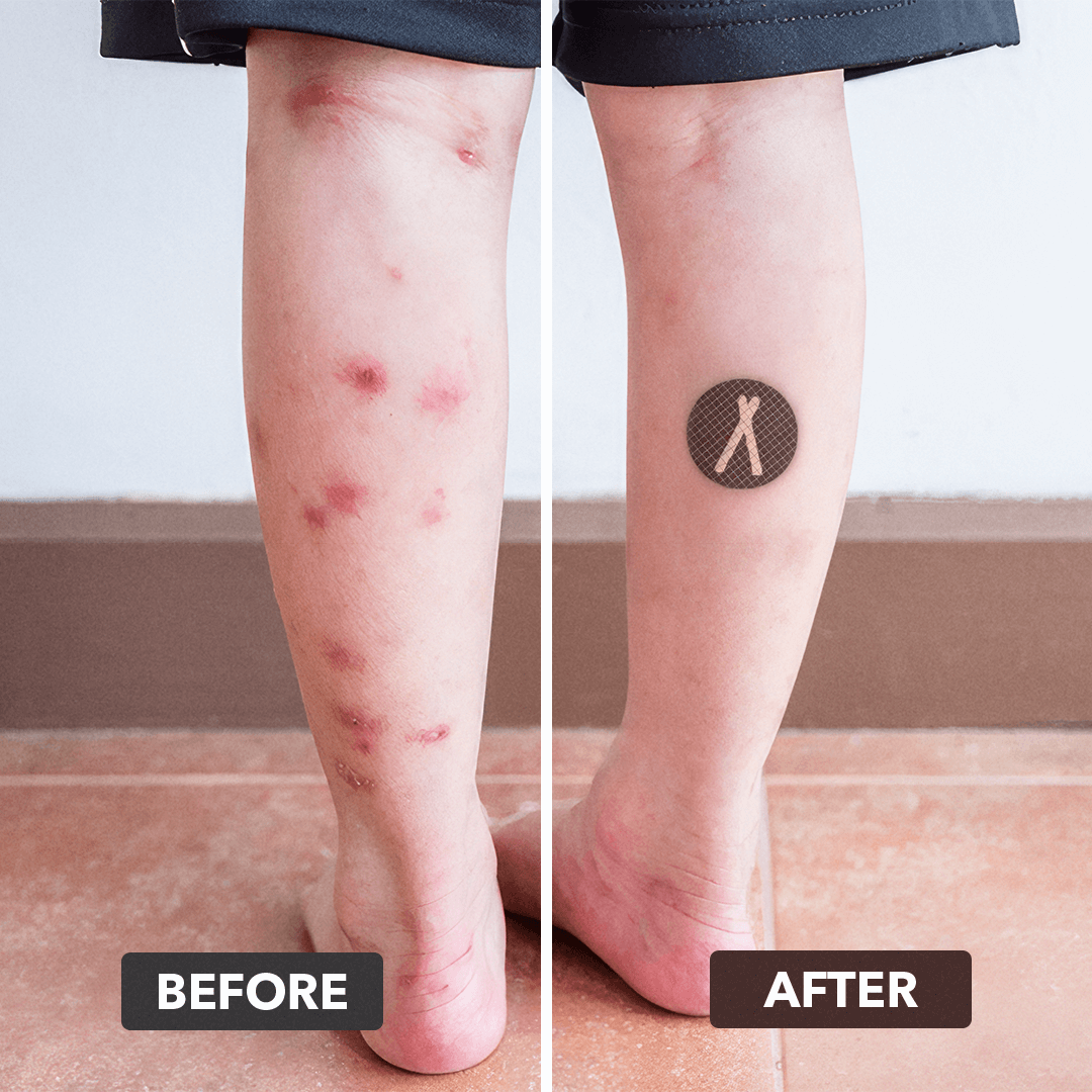 Autocollants Anti-Moustiques et Anti-Tiques Fjällbris